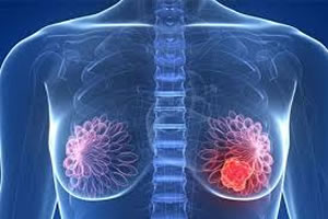 Mitos e verdades relacionado ao câncer de mama